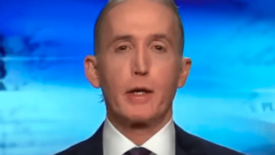 trey gowdy forehead surgery